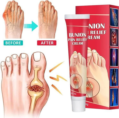 Bunion Pain Relief Cream (Pack Of 2)